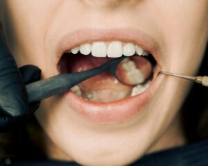 nhs dentist