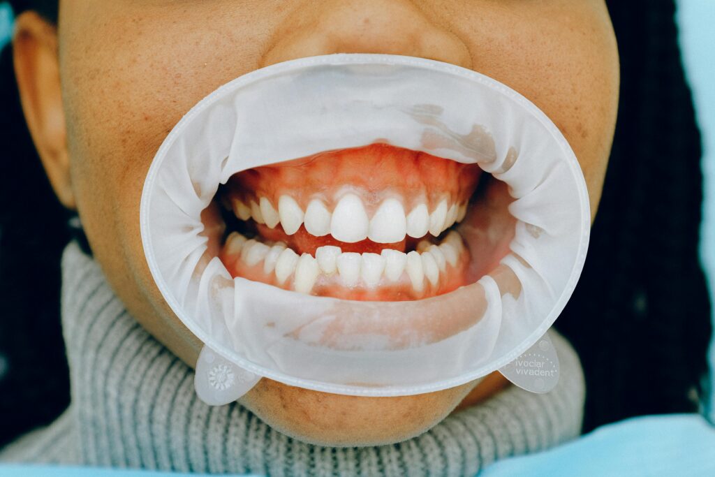 nhs dentist