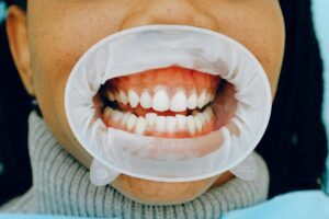 nhs dentist